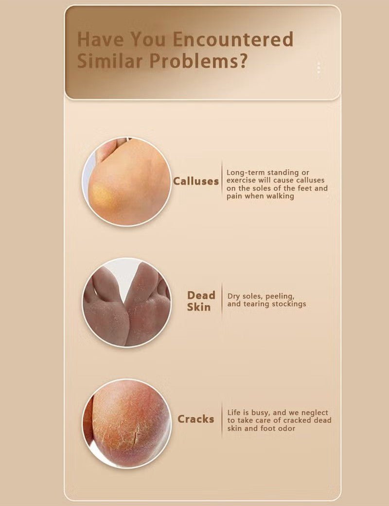 Handheld Electric Callus Remover